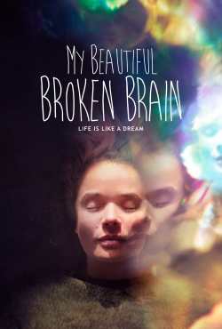 My Beautiful Broken Brain-free